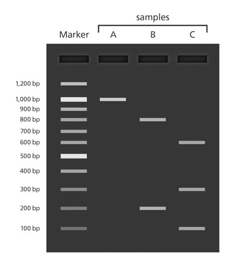 how to read a gel electrophoresis|How to Read Gel Electrophoresis Bands: Interpretation Guide .